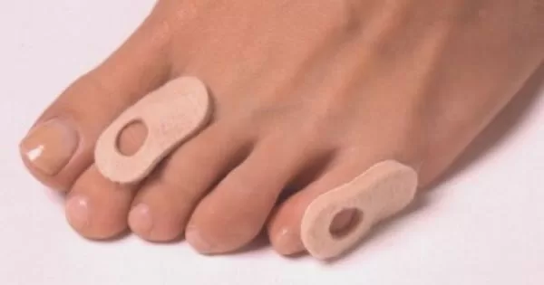 kuondoa sugu kwenye miguu