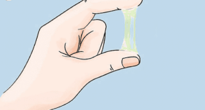 Ugonjwa wa trichomoniasis